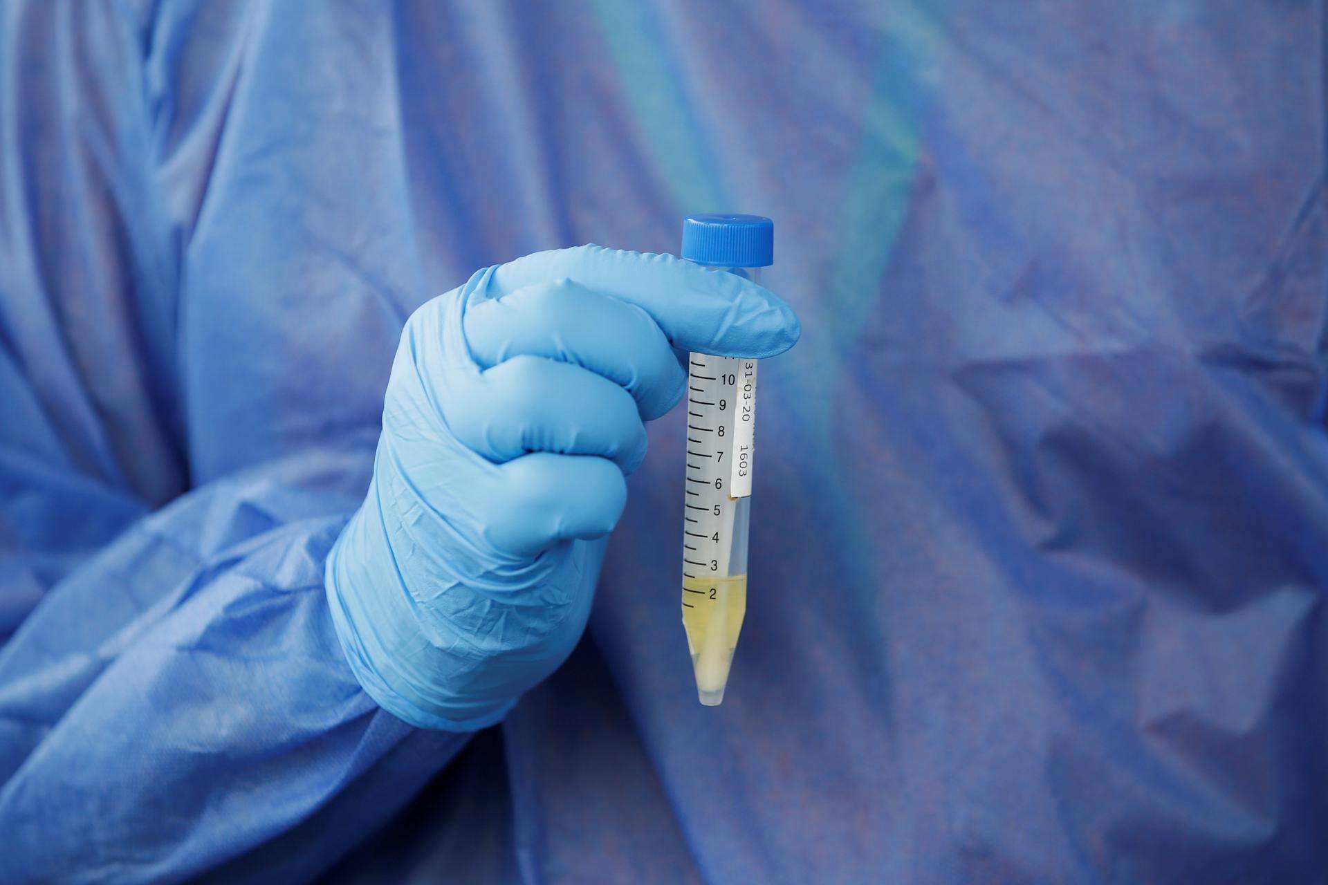 Panamá reporta el primer caso de la covid JN.1, un linaje de la nueva variante 'Pirola'