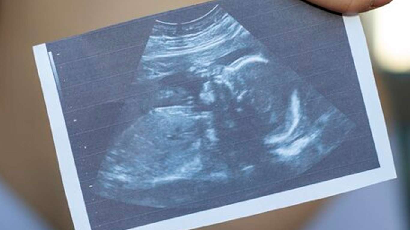 ¿Cómo afecta tomar antidepresivos durante el embarazo?