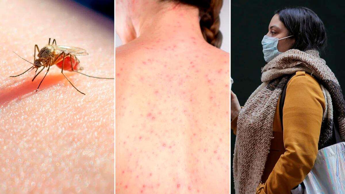 Dengue y COVID-19: ¿Qué debes saber para manejar ambas enfermedades efectivamente?