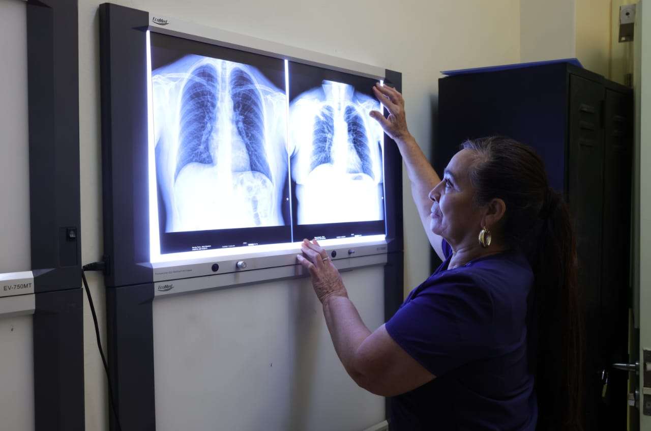 Nuevo equipo de Rayos X en el Hospital de Enfermedades Respiratorias mejora la atención a más de 2,500 pacientes