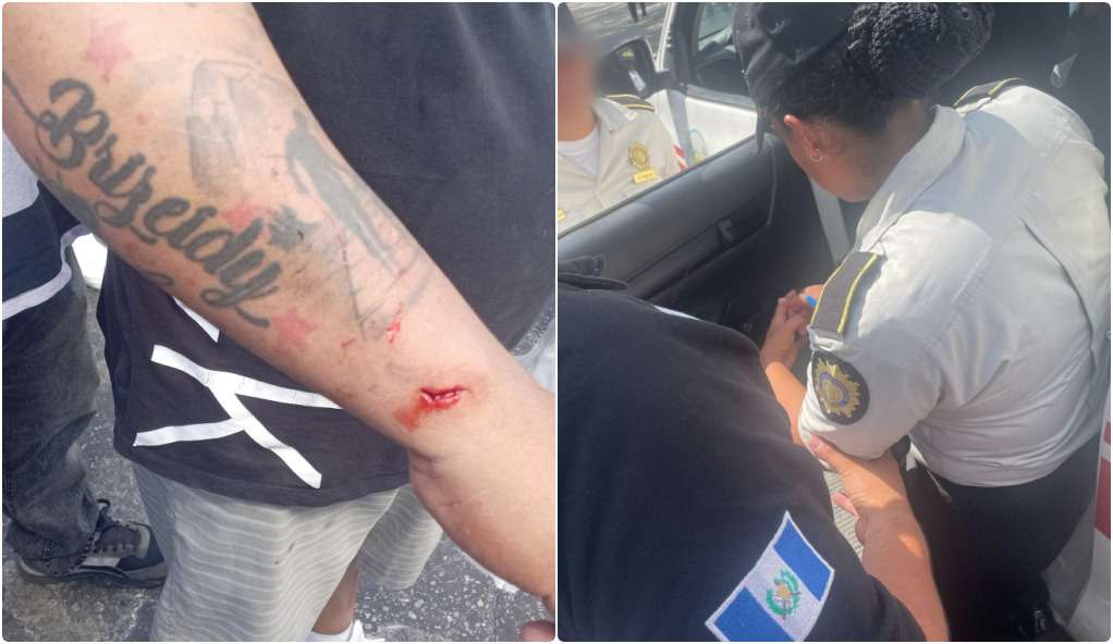 Cinco manifestantes y dos policías heridos tras enfrentamiento en zona 1