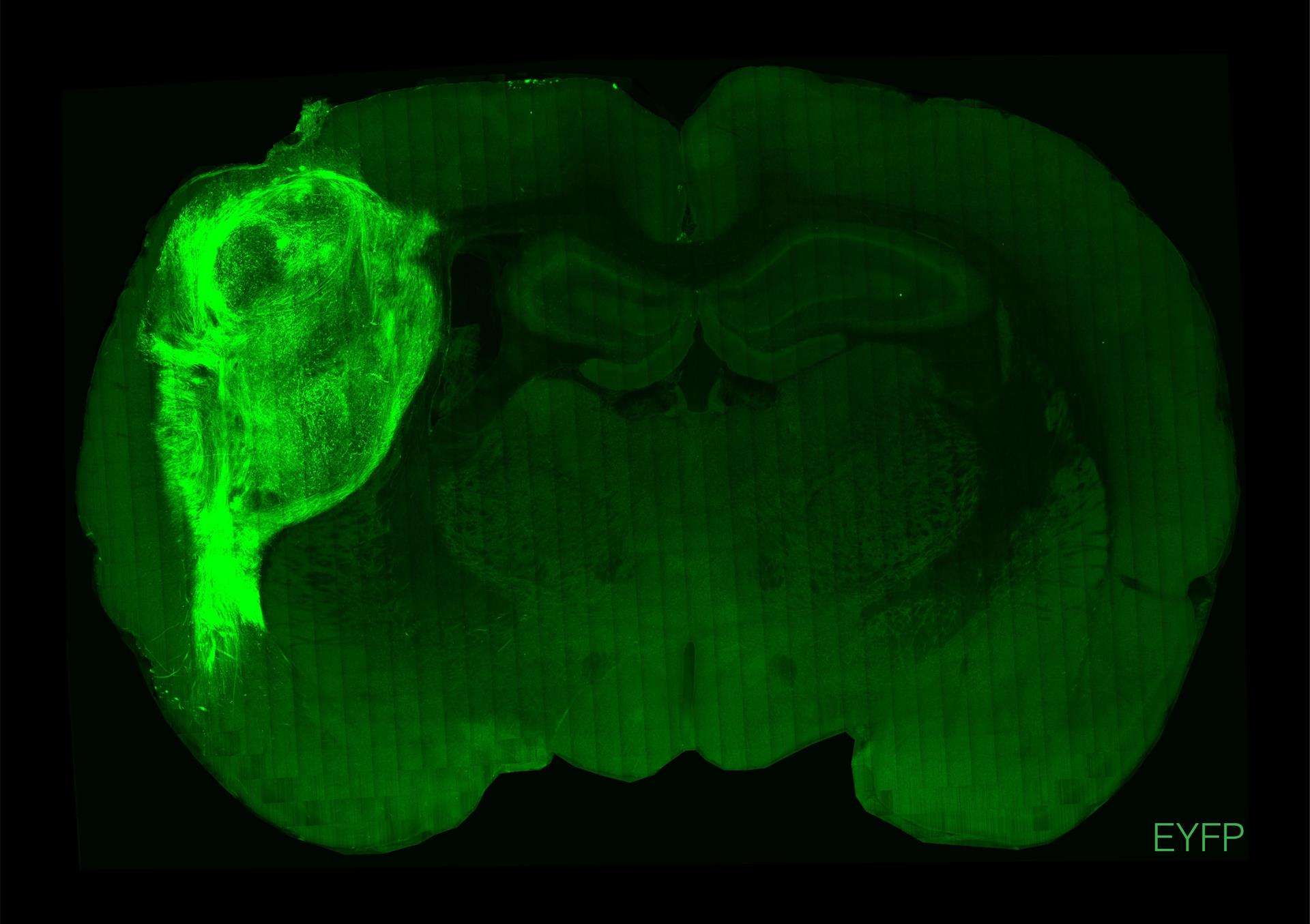 Un organoide humano trasplantado y marcado con una proteína fluorescente en una sección del cerebro de la rata.EFE/ Crédito: Universidad de Stanford.