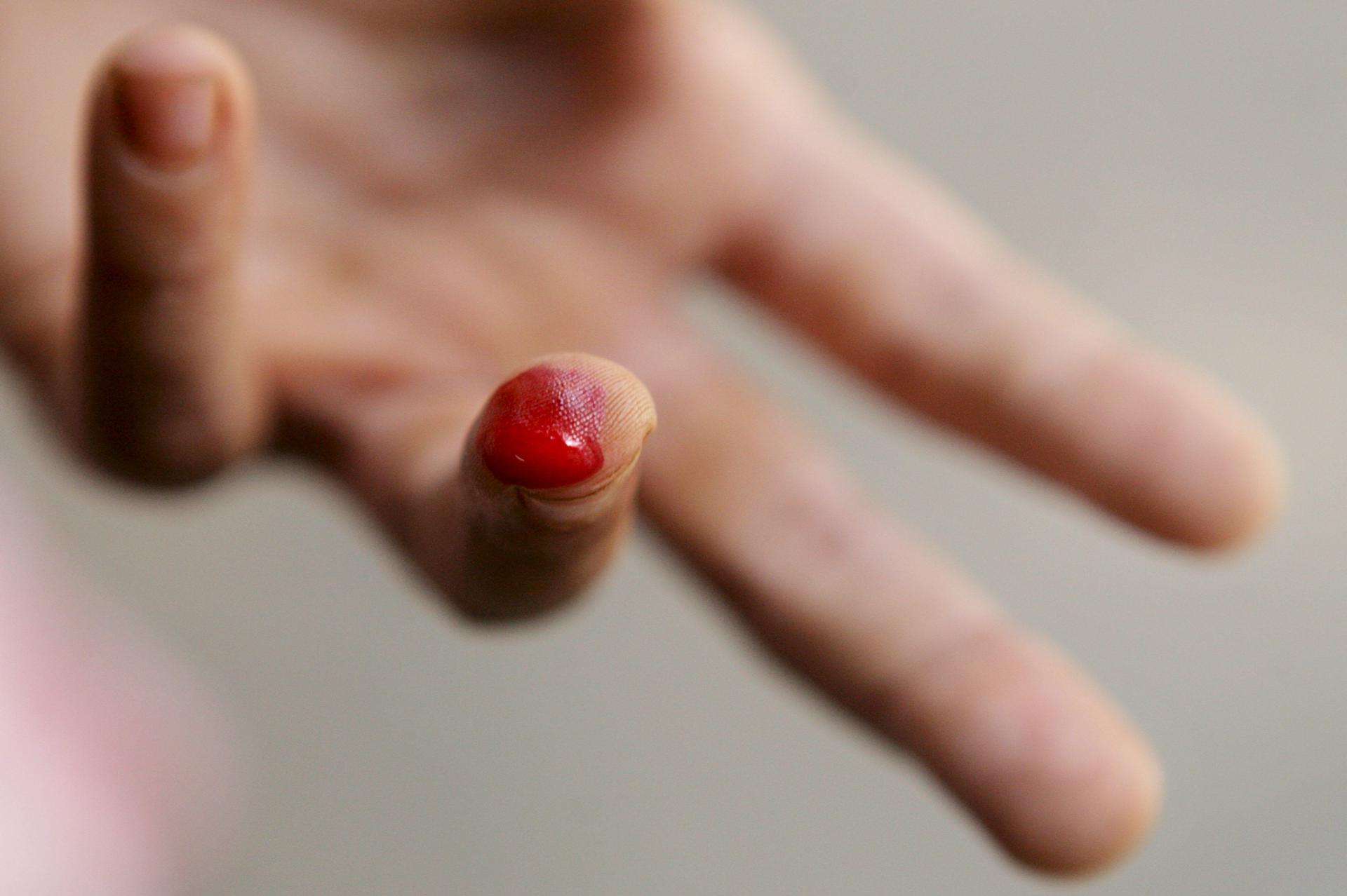 Científicos confirman la eficacia de combinar vacuna y fármacos para combatir la malaria